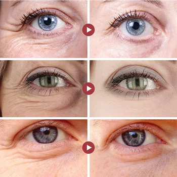 Retinol Anti-Wrinkle Eye Cream Pevnej Kože Odstrániť Očné Tašky Tmavé Kruhy Anti Aging Eye Opravy Zdvíhacích Spevnenie Oživiť Starostlivosť O Pleť Retinol Anti-Wrinkle Eye Cream Pevnej Kože Odstrániť Očné Tašky Tmavé Kruhy Anti Aging Eye Opravy Zdvíhacích Spevnenie Oživiť Starostlivosť O Pleť 4
