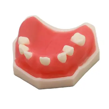 Zubné M2009 Implantát Praxi Model Zubné Zubár Školenia Štandardný Model pre Študentské Štúdie